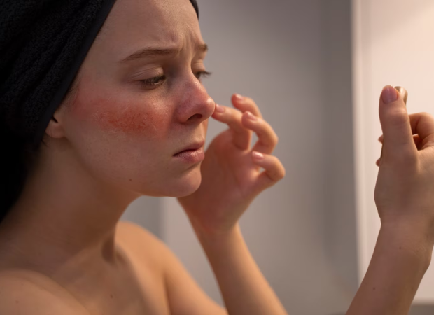 skin specialist in south delhi,
