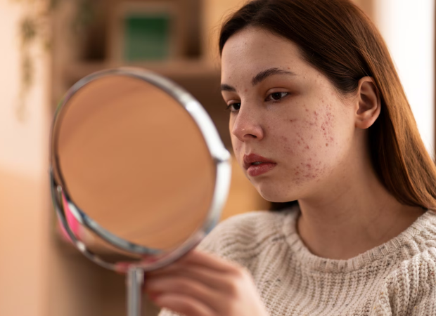 dark circles and pigmentation treatment