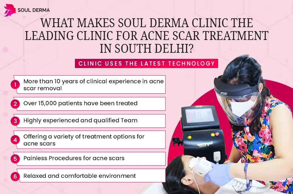 Acne Scar Treatment in South Delhi: Soul Derma Clinic utilizes the latest technology and equipment to treat acne scars, having treated over 15,000 patients.