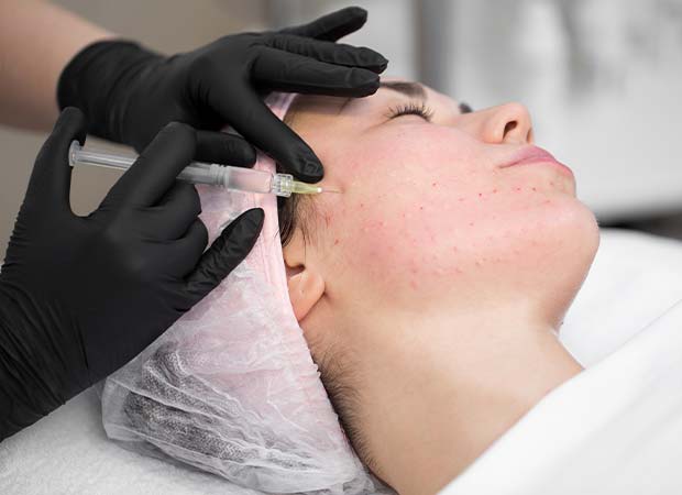 Vampire Facial Treatment in Greater Kailash : This treatment has been shown to improve the appearance of wrinkles, scars, and age spots.