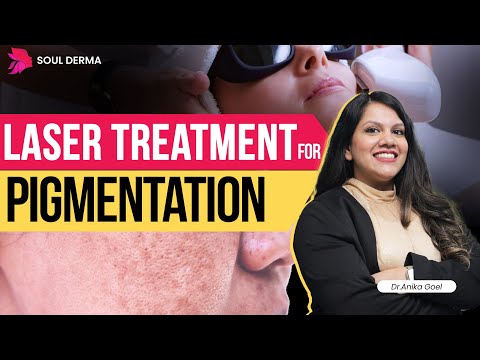 Laser Treatment for Pigmentation | Pigmentation Treatment in Greater Kailash | Soul Derma Clinic