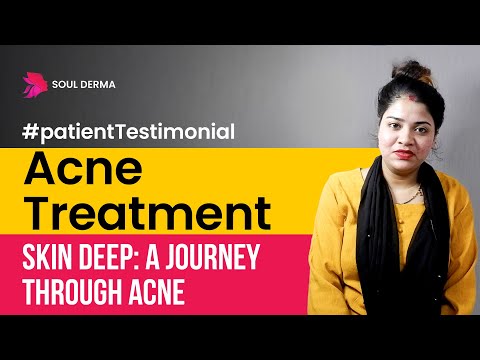 Acne Treatment by Dermatologist | Patient Testimonial | acne treatment in Greater Kailash