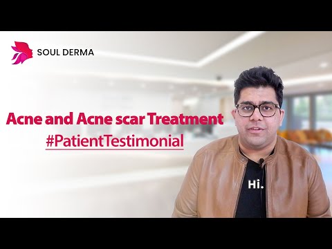 Patient Testimonial about Acne and Acne Scars | Acne Treatment in Greater Kailash | Soul Derma