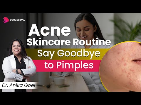 Acne SkinCare Routıne | Cause of Acne on Face | Acne Treatment in Greater kailash |Soul Derma Clinic
