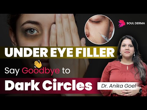 Filler for Dark Circles Under Eyes | Get rid of Under Eye Dark Circles | Soul Derma Clinic